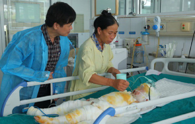 Sức khỏe 3 trẻ mầm non bị bỏng do cô giáo đốt cồn dạy học: Thông tin mới nhất-1