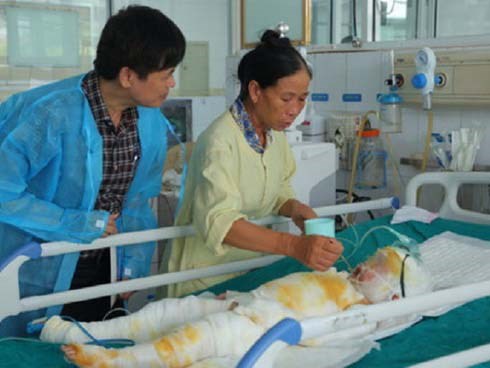 Sức khỏe 3 trẻ mầm non bị bỏng do cô giáo đốt cồn dạy học: Thông tin mới nhất