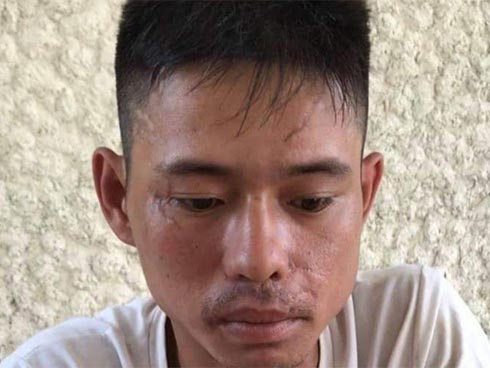 Dâm ô bé gái 7 tuổi, người đàn ông được cho tại ngoại: Hội Bảo vệ Quyền trẻ em TP.HCM nói gì?-2