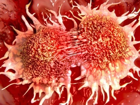 Chỉ mặt 5 đồ vật có mùi thơm nhưng cực kì độc hại, có thể gây ung thư-2