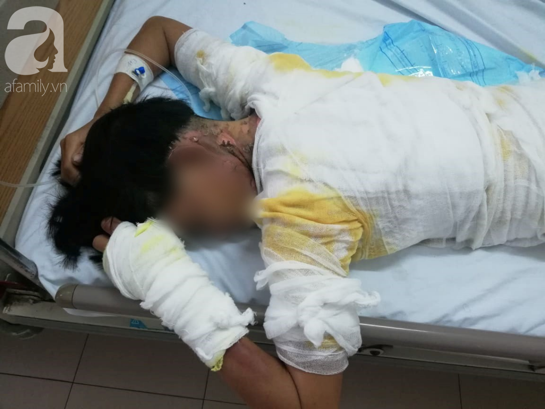 Vụ chồng tẩm xăng thiêu sống cả nhà vì vợ dỗ con không nín: Người mẹ hoảng loạn, bé trai 2 tuổi bị nhiễm trùng nặng-3