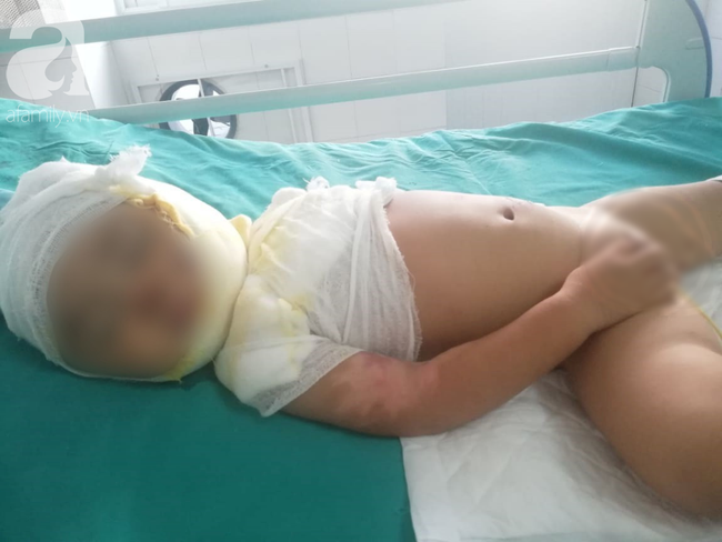 Vụ chồng tẩm xăng thiêu sống cả nhà vì vợ dỗ con không nín: Người mẹ hoảng loạn, bé trai 2 tuổi bị nhiễm trùng nặng-4