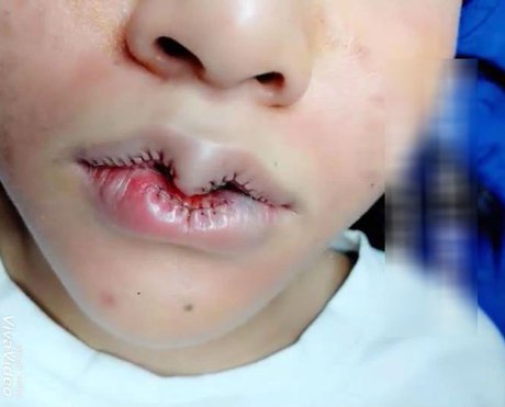 Ai bảo cứ môi trái tim là đẹp, cứ nhìn những ca thẩm mỹ này thì SÁNG MẮT NGAY-5