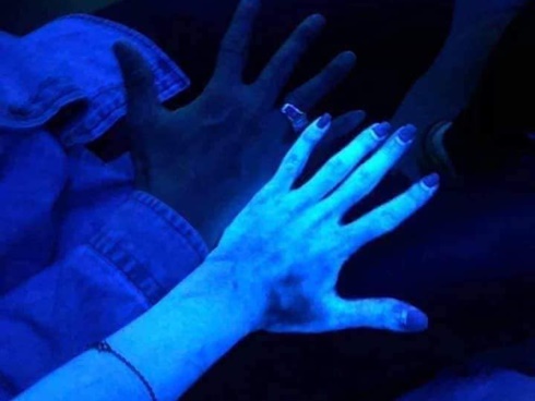 Suýt tử vong sau 30 phút truyền chất làm trắng da tại spa-2