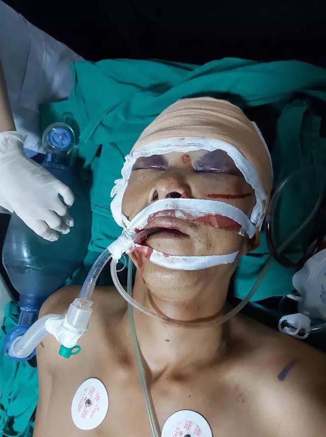 Xôn xao thông tin CSGT đuổi người vi phạm dẫn đến tai nạn chấn thương sọ não ở Phú Thọ-3