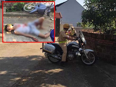 Cha mẹ chủ quan, bé gái suýt chết vì chấn thương sọ não sau té ngã-4