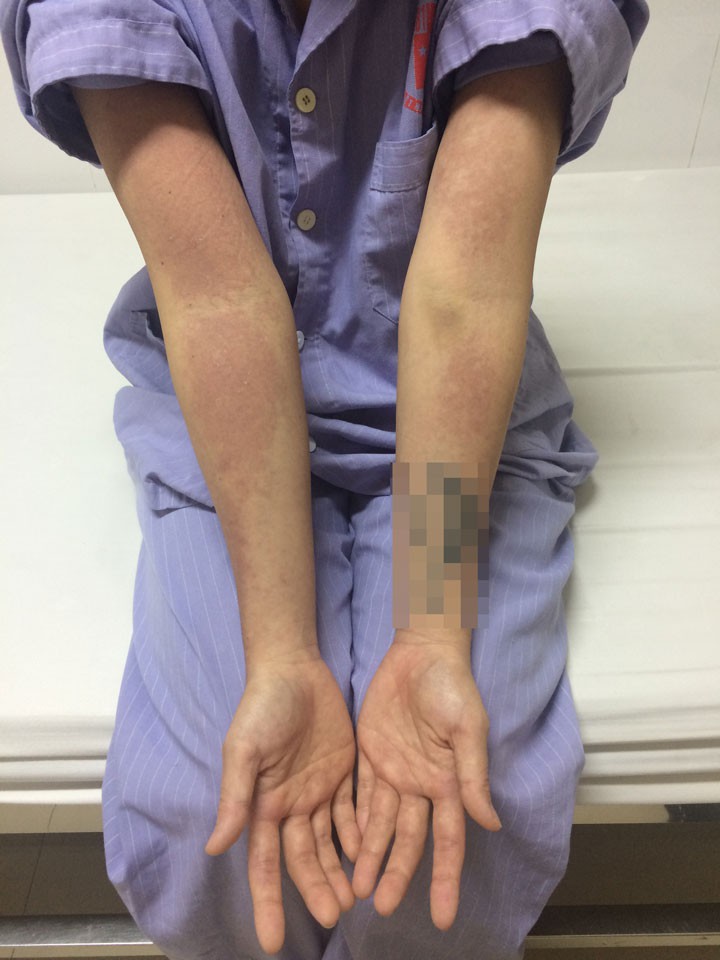 Chăm sóc da mặt theo những cách này, nhiều chị em khóc nghẹn vì da đóng vảy, sần sùi khó phục hồi-5