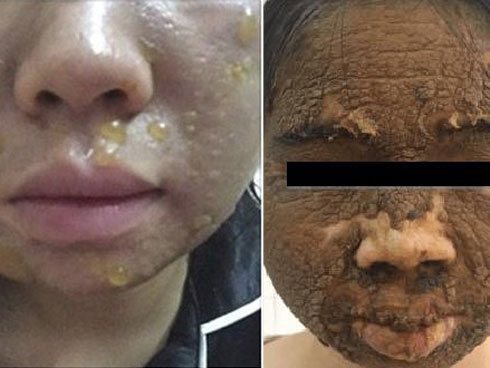 Không khí đang ô nhiễm trầm trọng, chị em cần lưu ý chăm sóc da theo 4 bước này để luôn xinh đẹp-13