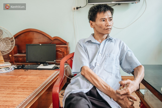 Số phận cay đắng của người cây kì lạ nhất Việt Nam: Mẹ cõng con đi điều trị gần 50 năm, phải uống thuốc ngủ để quên cơn đau-2