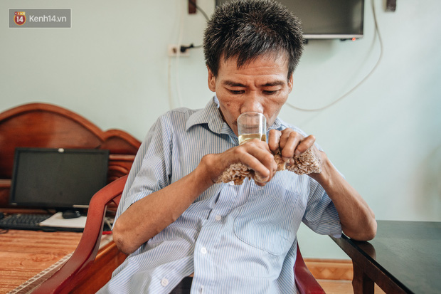 Số phận cay đắng của người cây kì lạ nhất Việt Nam: Mẹ cõng con đi điều trị gần 50 năm, phải uống thuốc ngủ để quên cơn đau-6