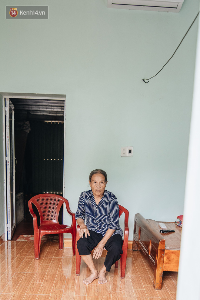 Số phận cay đắng của người cây kì lạ nhất Việt Nam: Mẹ cõng con đi điều trị gần 50 năm, phải uống thuốc ngủ để quên cơn đau-8