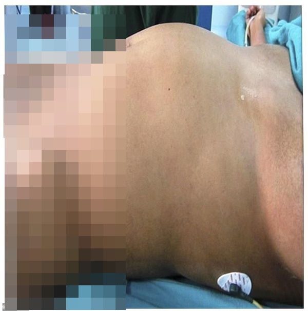 Nhập viện vì đau dạ dày, thiếu nữ hoảng hồn vì mang song thai suốt 17 năm mà không hề hay biết-1