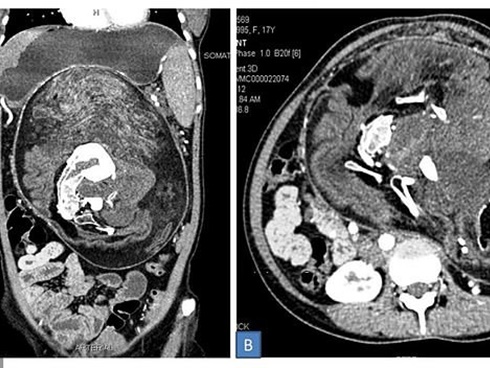 Ai cũng nghĩ uống trà, ăn chuối khi đói hại dạ dày nhưng đây mới là thực phẩm cần tránh-7