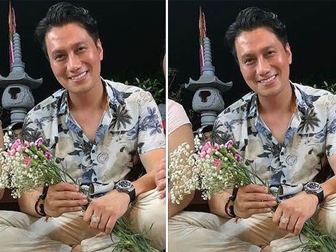 Bị chê diện mạo sau thẩm mỹ, Việt Anh đáp trả gay gắt