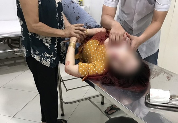 Cô gái bị đối tượng đi xe SH dùng dao đâm nhiều nhát vào cổ, ngã gục xuống đường-1