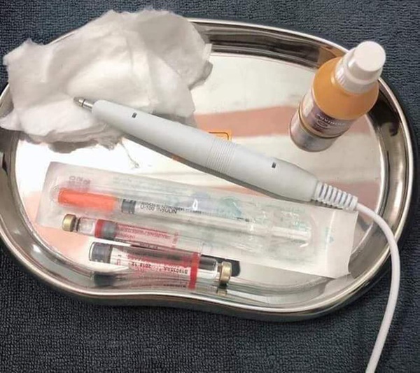 Rùng mình với hình ảnh đốt ổ hôi nách lan truyền trên mạng xã hội, nhìn thôi cũng thấy đau nhưng nhiều chị em vẫn cắn răng làm-6