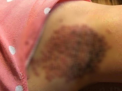 Rùng mình với hình ảnh