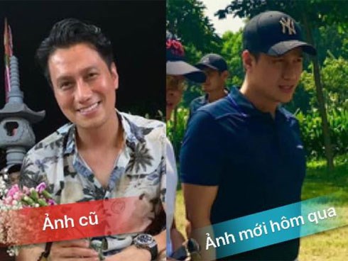 Việt Anh thừa nhận cải thiện nhan sắc cũng là thay đổi tướng số