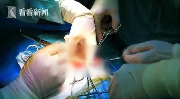 Bé trai 4 tuổi có bụng nhô cao như phụ nữ mang thai và nguyên nhân khiến mọi người giật mình-4