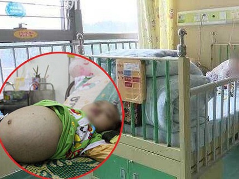 Đang mang thai vẫn có thể dính bầu, chuyện tưởng hoang đường nhưng hoàn toàn có thật-5