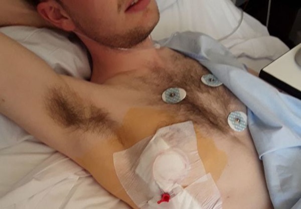Chàng trai 20 tuổi thủng phổi sau khi chơi tàu lượn siêu tốc-2
