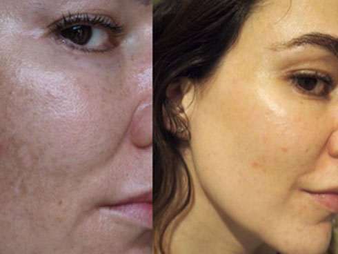 Da bạn sẽ luôn căng bóng, còn nếp nhăn thì chẳng dám lộ diện nếu chăm ăn 5 thực phẩm sau-6