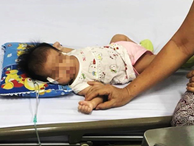 TP.HCM: Bé gái 40 ngày tuổi ngưng tim, ngưng thở nguy kịch vì sặc sữa khi đang bú mẹ