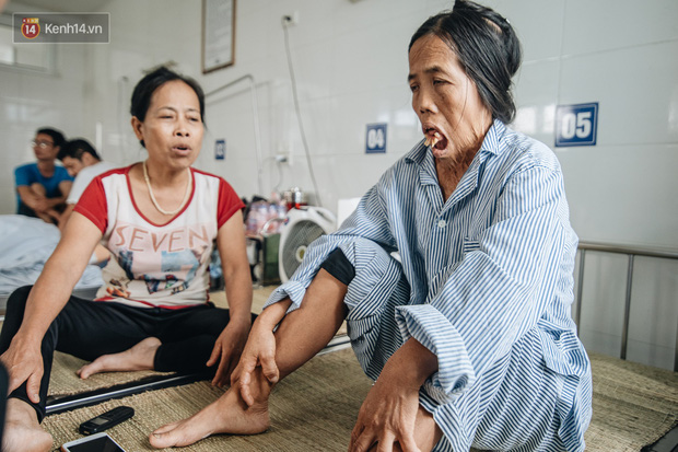 Phép màu đến với người phụ nữ gần 50 năm không ngậm được miệng-2