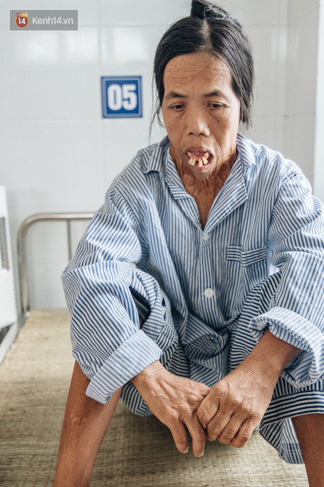 Phép màu đến với người phụ nữ gần 50 năm không ngậm được miệng-5