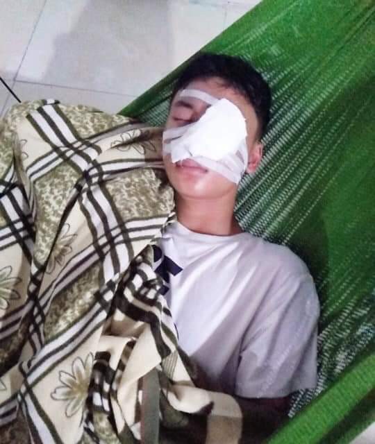 Nam sinh lớp 10 bị nát mặt vì chó lạ tấn công-2