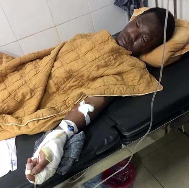 Thương tâm bé trai 7 tháng tuổi cùng cha mẹ bị bỏng nặng do hở gas lúc đun nấu-2