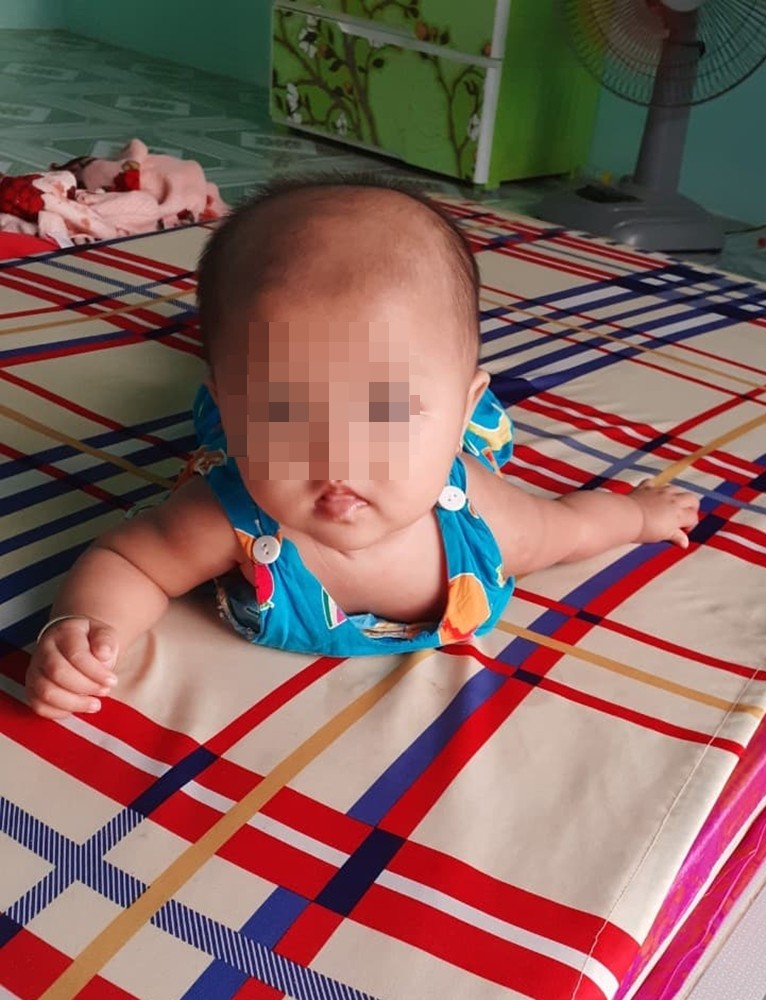 Mẹ của bé gái 8 tháng tuổi nghi bị xuất huyết não ngay ngày đầu tiên gửi nhà trẻ: Cô giáo nói bé tự bị còn camera thì hỏng?-4