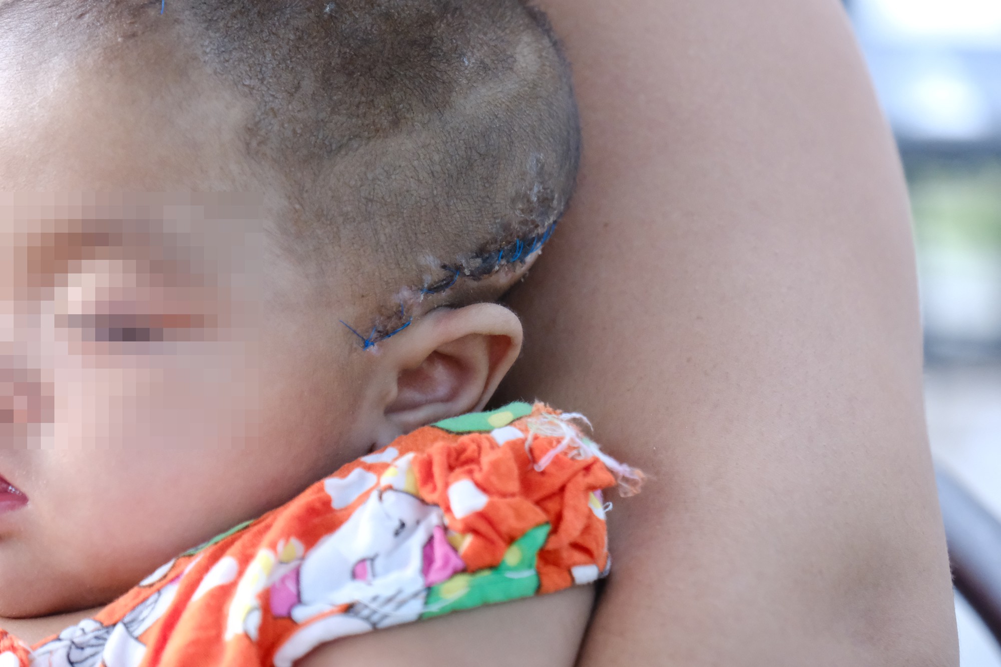 Mẹ của bé gái 8 tháng tuổi nghi bị xuất huyết não ngay ngày đầu tiên gửi nhà trẻ: Cô giáo nói bé tự bị còn camera thì hỏng?-8