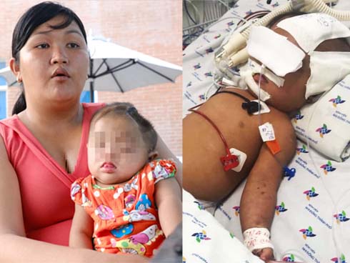 Vụ bé gái 8 tháng tuổi nghi xuất huyết não ngay ngày đầu đi nhà trẻ: Giám định bé bị thương tật đến 84%-2