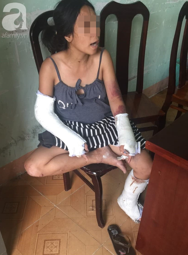 Nghi án vợ đang mang thai 7 tháng bị chồng hành hạ, đánh đập nhiều lần đến hỏng mắt, người chi chít vết thương-2