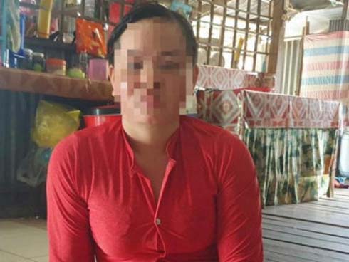 Cặp song sinh dính liền chung 1 lá gan được phẫu thuật tách rời-3