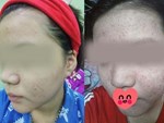 Bác sĩ da liễu kỳ thị 5 sản phẩm skincare này, bạn đừng dùng kẻo da đã kém đẹp lại càng xấu tệ-5