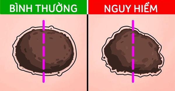 5 tín hiệu từ nốt ruồi cảnh báo ung thư đang tiềm ẩn dưới làn da-1