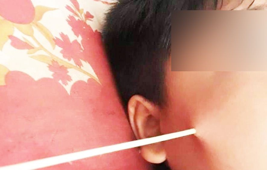 Học sinh bị que đâm thủng mặt ở trường: Cha mẹ đừng chỉ lo sợ suông, hãy can thiệp ngay các vấn đề sau-1