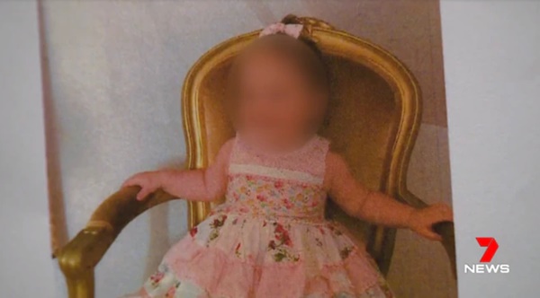 Cha mẹ cho con ăn chay, bé gái 19 tháng tuổi bị suy dinh dưỡng, co giật và cân nặng chưa được 5kg-1