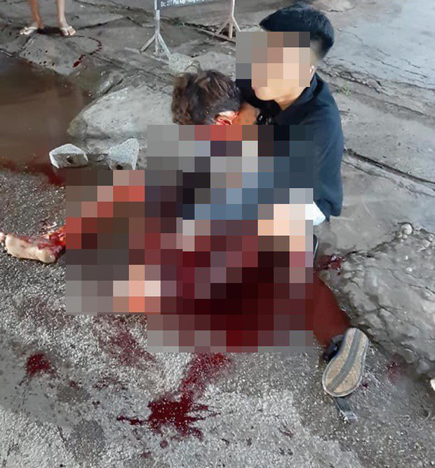 Bị chê tóc xấu, rút dao đâm người nguy kịch-2