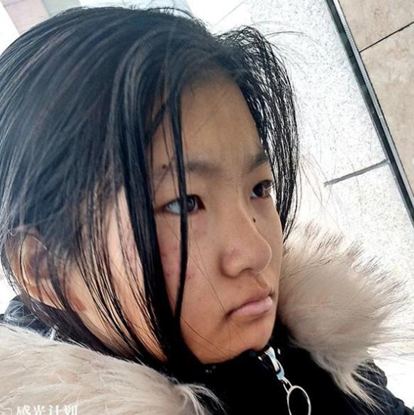 Bé gái 14 tuổi buộc phải dùng thuốc tránh thai 3 lần/ngày, lý do thực sự khiến ai cũng thương xót-2