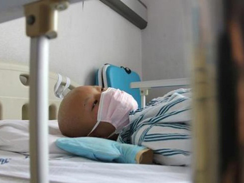 Căn bệnh ở cổ, chị em mắc nhiều hơn nam giới: Rụng tóc, giảm ham muốn hãy coi chừng-4