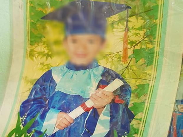 Bé trai 13 tuổi tử vong vì bị gãy xương nhưng mổ ruột thừa?-1