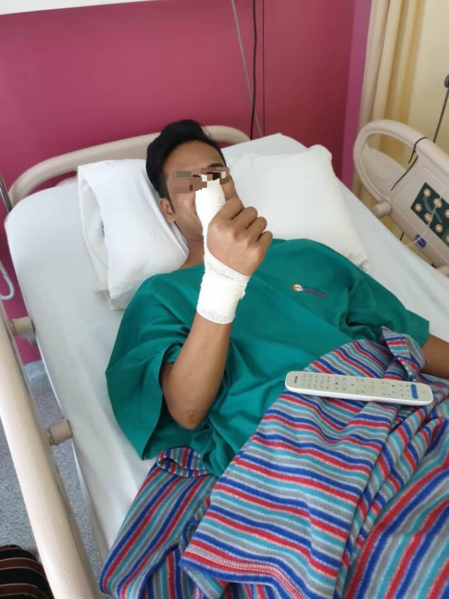 Suýt mất ngón tay vì sử dụng smartphone với tấm dán cường lực màn hình bị vỡ-2