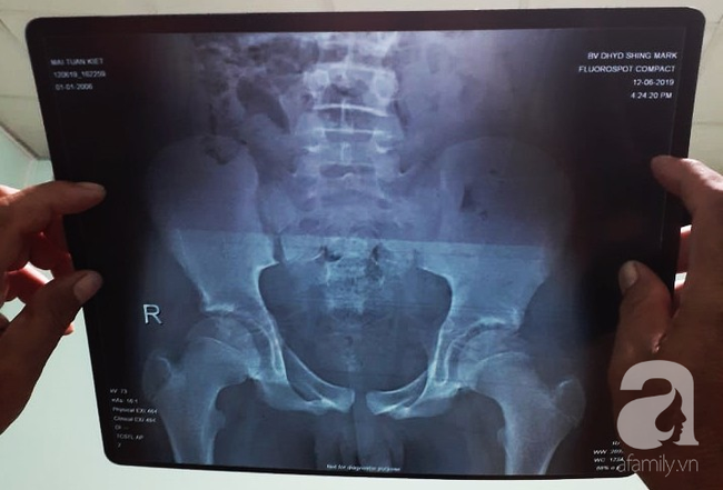 Bệnh viện Nhi đồng Đồng Nai phản hồi vụ người cha tố bác sĩ chẩn đoán sai khiến con trai 13 tuổi chết oan-8