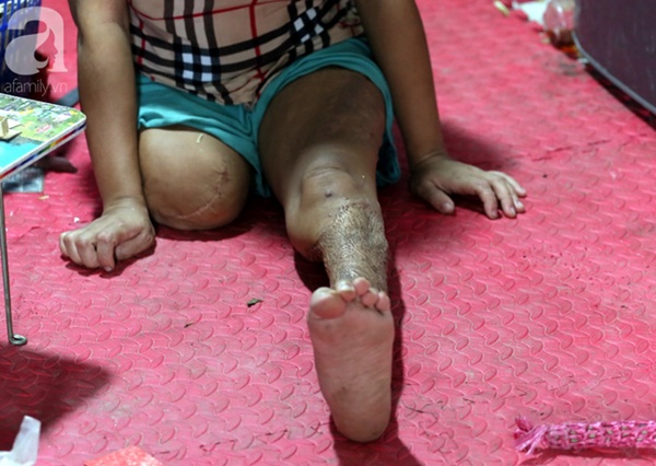 Chuyện rớt nước mắt sau túp lều dựng tạm ven đường của người mẹ cụt chân, một mình nuôi con trai khờ ở Hà Nội-3