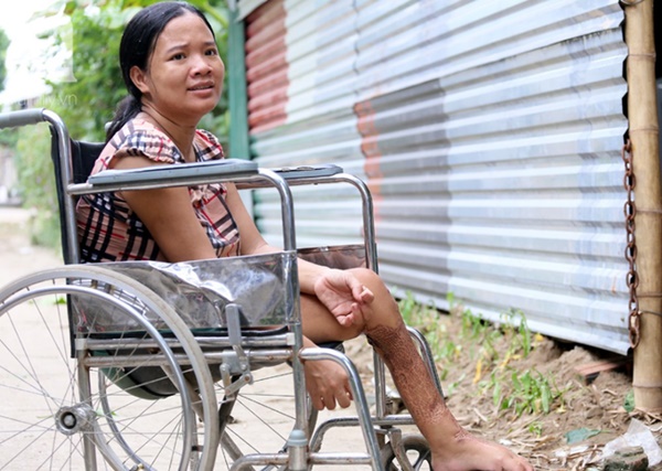 Chuyện rớt nước mắt sau túp lều dựng tạm ven đường của người mẹ cụt chân, một mình nuôi con trai khờ ở Hà Nội-6