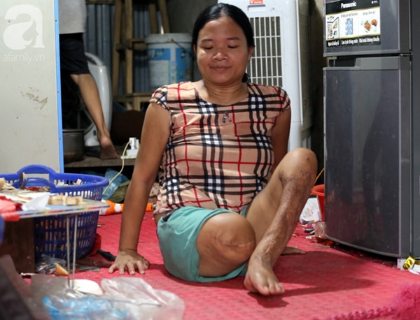 Chuyện rớt nước mắt sau túp lều dựng tạm ven đường của người mẹ cụt chân, một mình nuôi con trai khờ ở Hà Nội-12