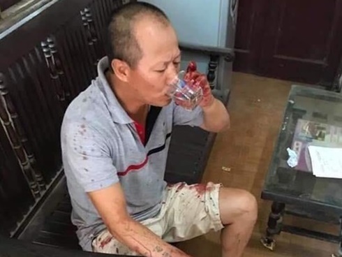 Vụ anh ruột truy sát cả gia đình em trai: Thêm bé gái 14 tháng tuổi tử vong-2